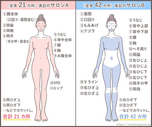 脱毛サロンおすすめ