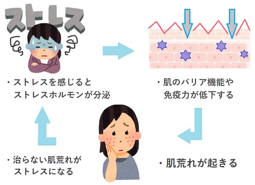 ストレス肌荒れ改善人気おすすめランキング