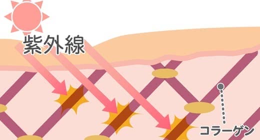 ほうれい線原因