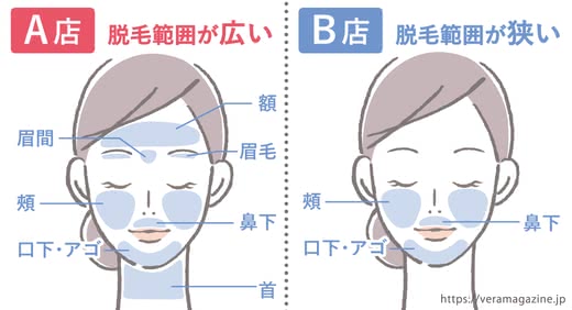 顔脱毛