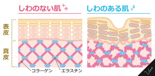 リンクルクリームシワ改善効果口コミ