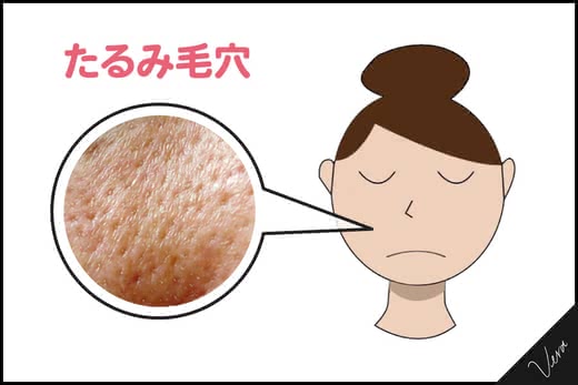 毛穴化粧品