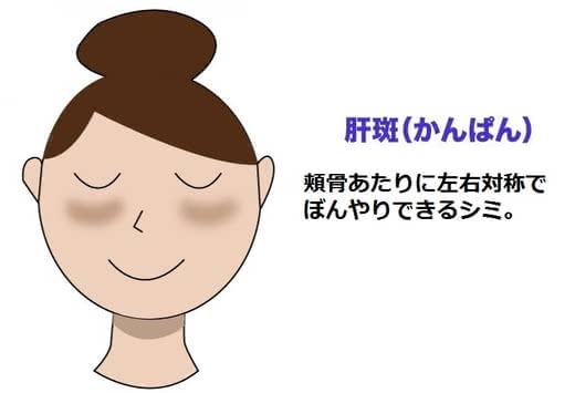 シミ美白美容液人気おすすめランキング