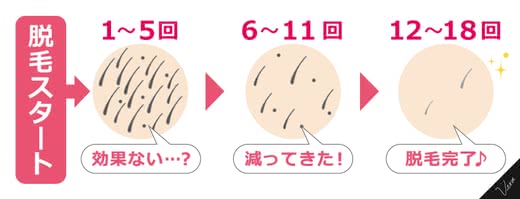 脱毛効果回数