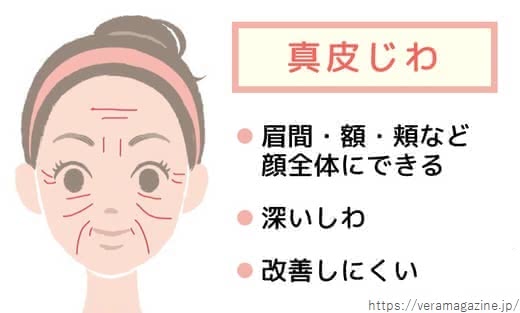 小じわクリーム