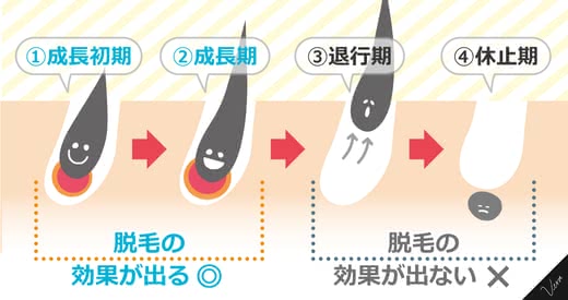 脱毛効果回数