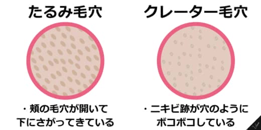 毛穴洗顔黒ずみおすすめ人気ランキング