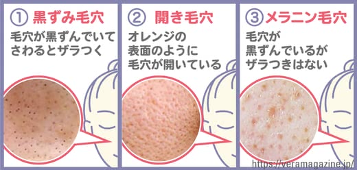 毛穴洗顔