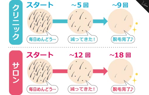 顔脱毛