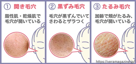 毛穴乳液