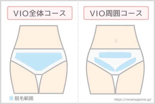 VIO脱毛,おすすめ
