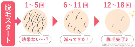 脱毛サロンおすすめ