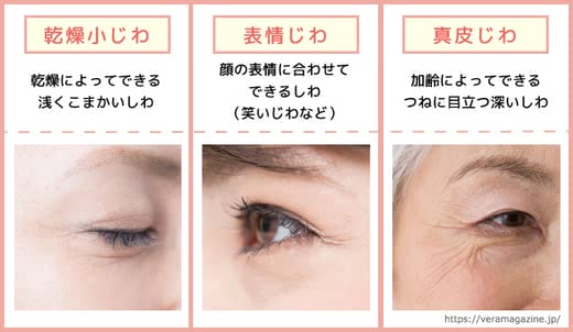 目元のしわの解消法