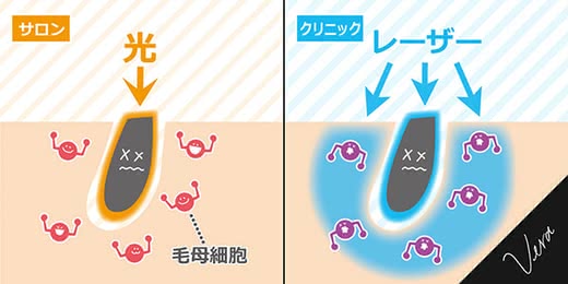 脱毛クリニック人気おすすめランキング