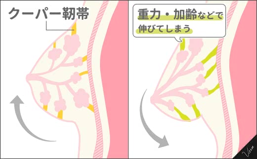 ナイトブラおすすめ