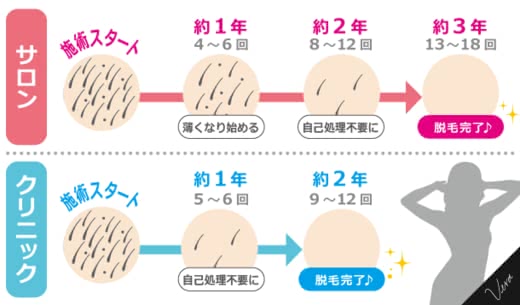 足脱毛クリニックサロン人気おすすめランキング