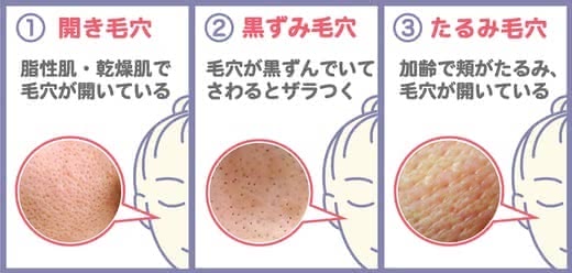 毛穴化粧水