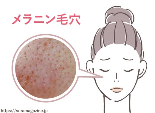 毛穴化粧品ランキング