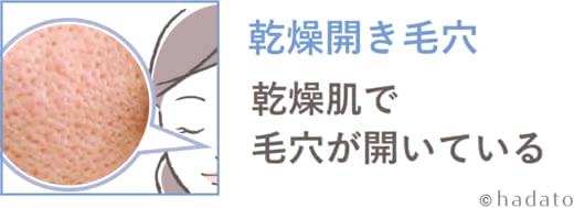 毛穴スキンケア