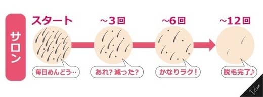 全身脱毛