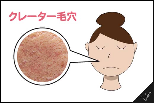毛穴化粧品