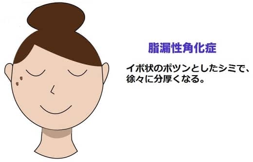 シミ美白美容液人気おすすめランキング