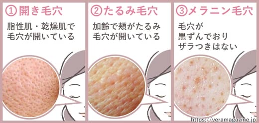 毛穴洗顔