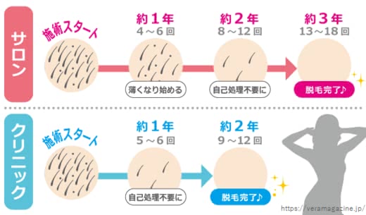 足脱毛クリニックサロン人気おすすめランキング