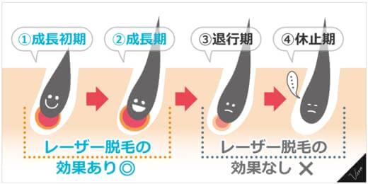 医療脱毛回数