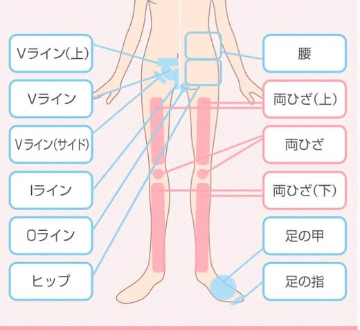 キレイモ口コミ