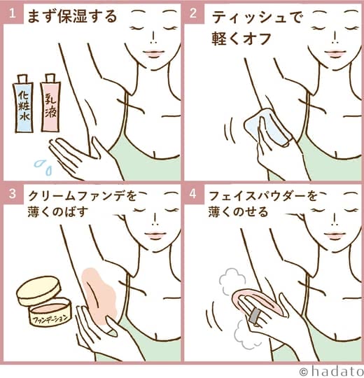 脇黒ずみ消す治す