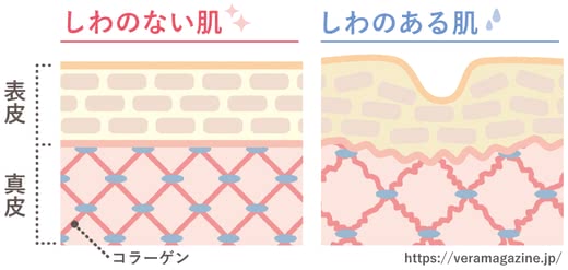 顔しわ