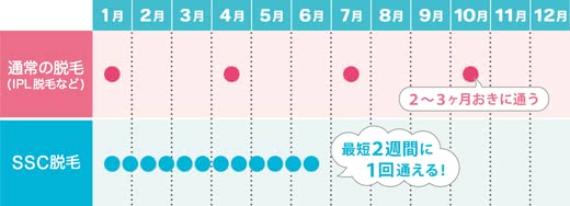 SSC脱毛