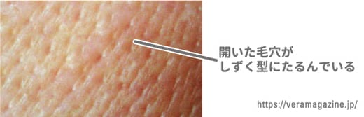 毛穴クレンジング