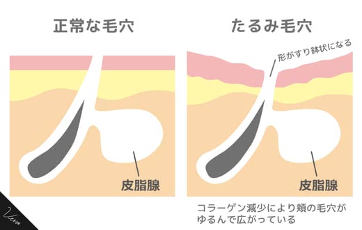 毛穴化粧水