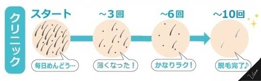 VIO 医療脱毛