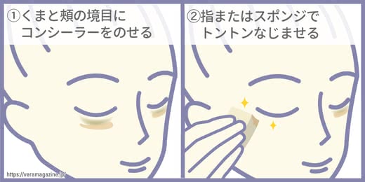 目元のくまを解消する方法