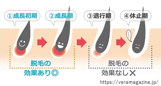 全身脱毛