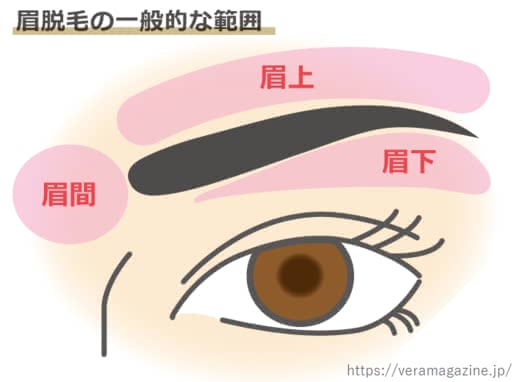 眉毛脱毛おすすめ人気ランキングサロンクリニック