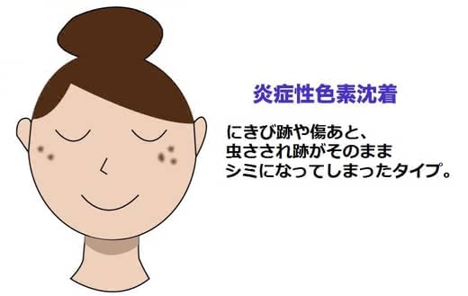 シミ美白美容液人気おすすめランキング