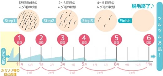 レーザー脱毛人気おすすめランキング