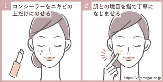 ニキビコンシーラー