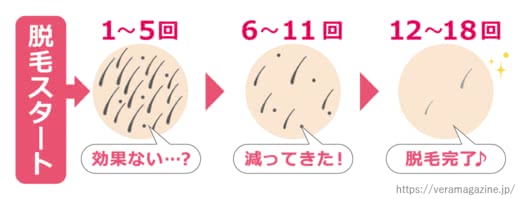 光脱毛人気おすすめランキング