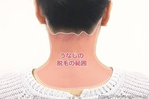 うなじ脱毛サロンクリニック人気おすすめランキング形回数