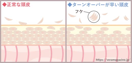 フケシャンプー