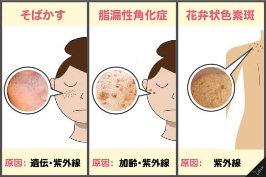 シミ消しクリームおすすめ
