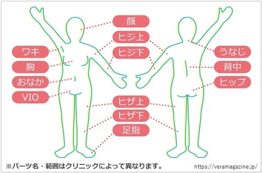 脱毛クリニック人気おすすめランキング