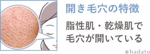 毛穴スキンケア