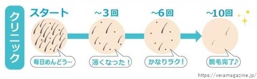 レーザー脱毛人気おすすめランキング
