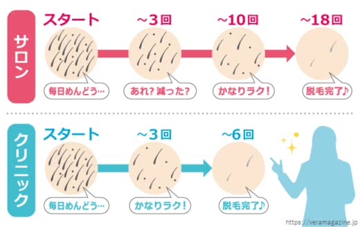 背中脱毛
